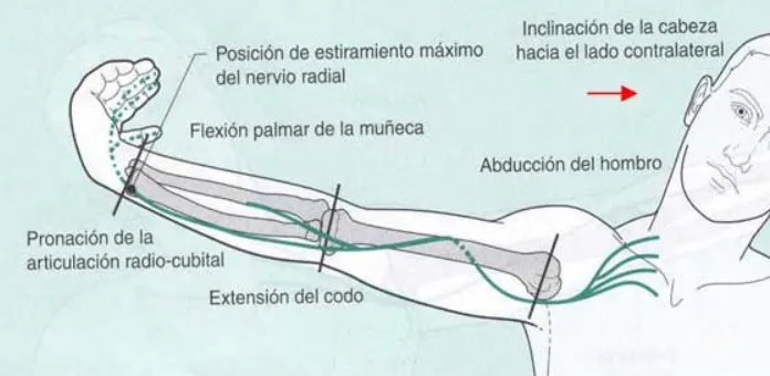 nervio radial