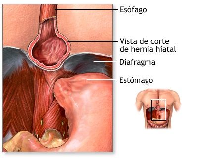 IMG RELACIONADA CON EL ARTICULO