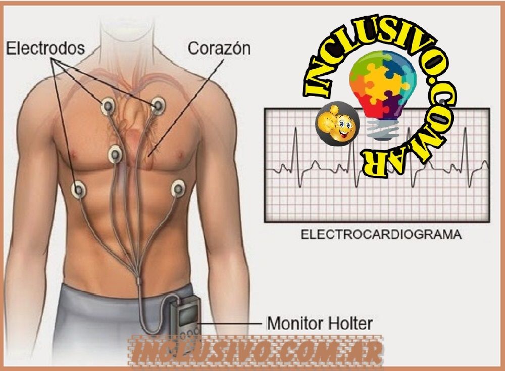 img- ilustrativa del contenido